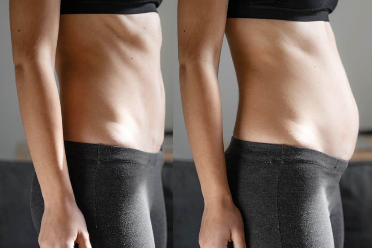 How long does diastasis recti take to improve Kew?