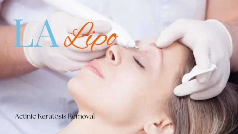 Woman receiving Actinic Keratosis Removal Treatment Kew