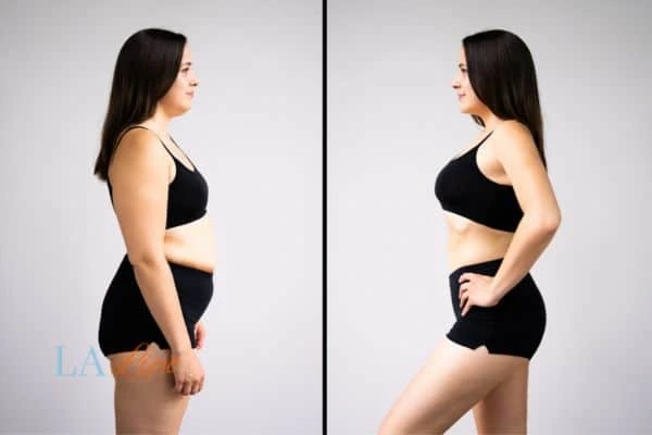 LA-EMS Body Sculpting Kew results before and after of womans results on body toning.