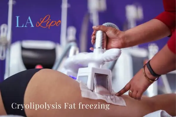 women getting fat freezing Kew