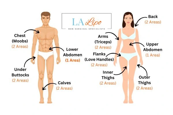 LA LIPO Cryolipolysis Areas Kew