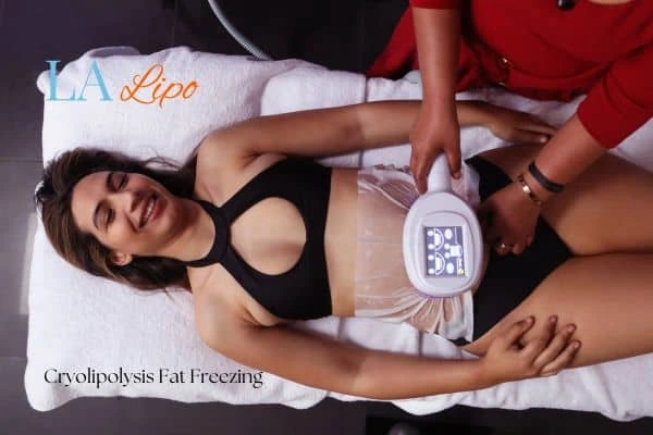 woman getting cryolipolysis Kew