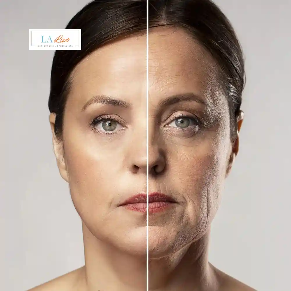 How Can You Tell If Non-Surgical Skin Tightening Is Right for You Kew?