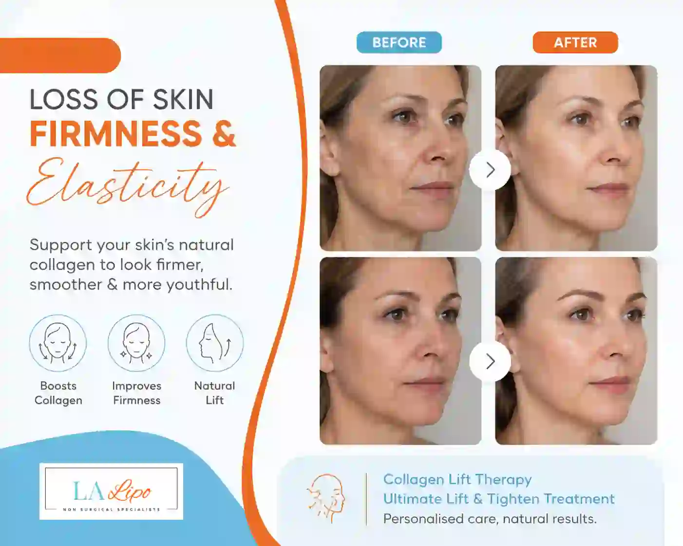 Sign #7: Loss of Skin Firmness and Elasticity Kew